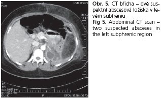 CSGH 5/2006